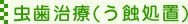 虫歯治療(う蝕処置)